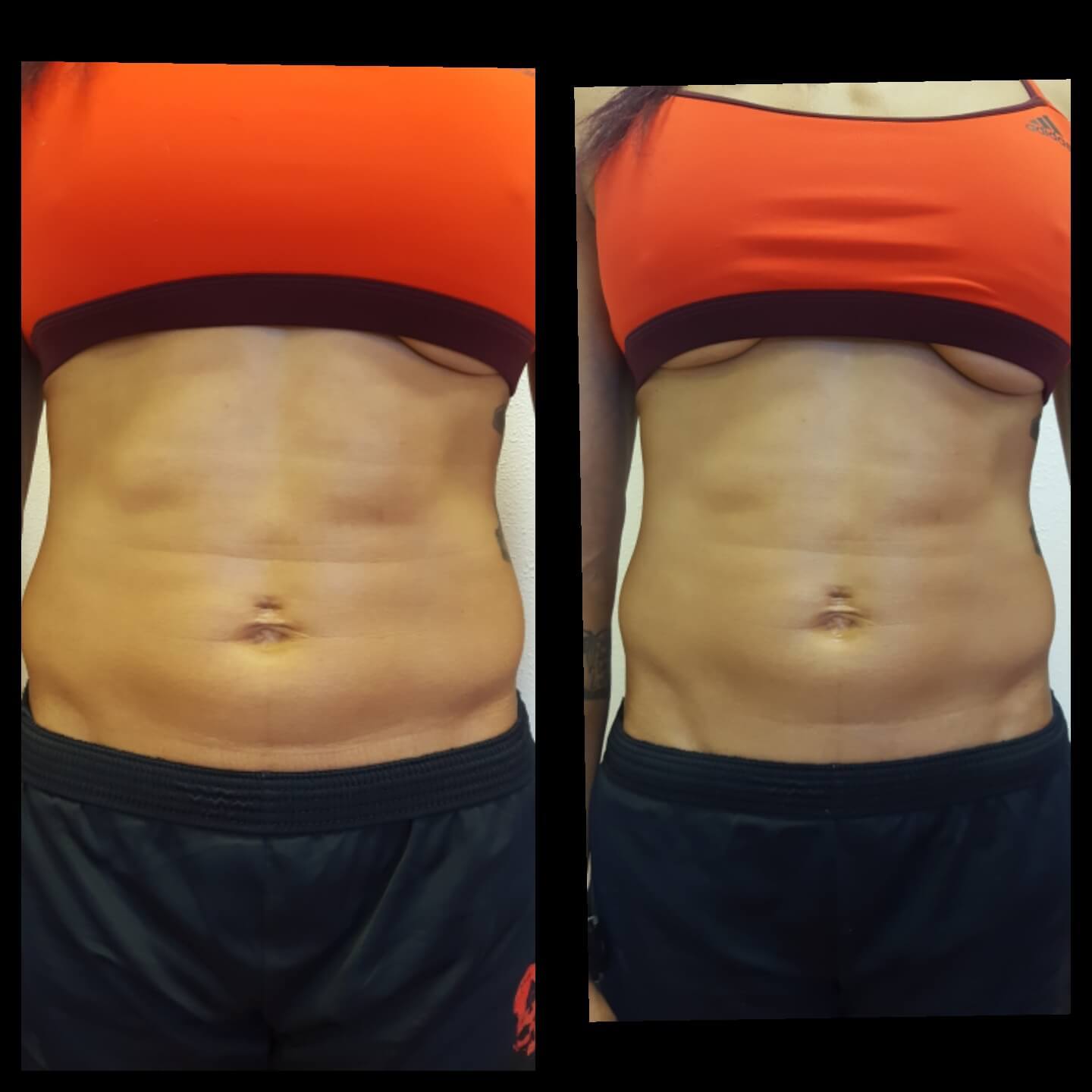 Before and after abs female