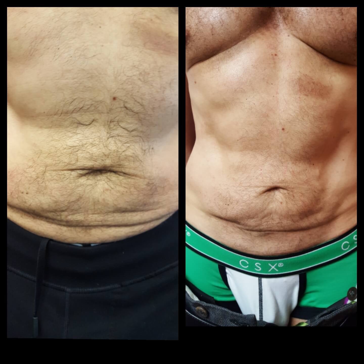 Before and after abs male