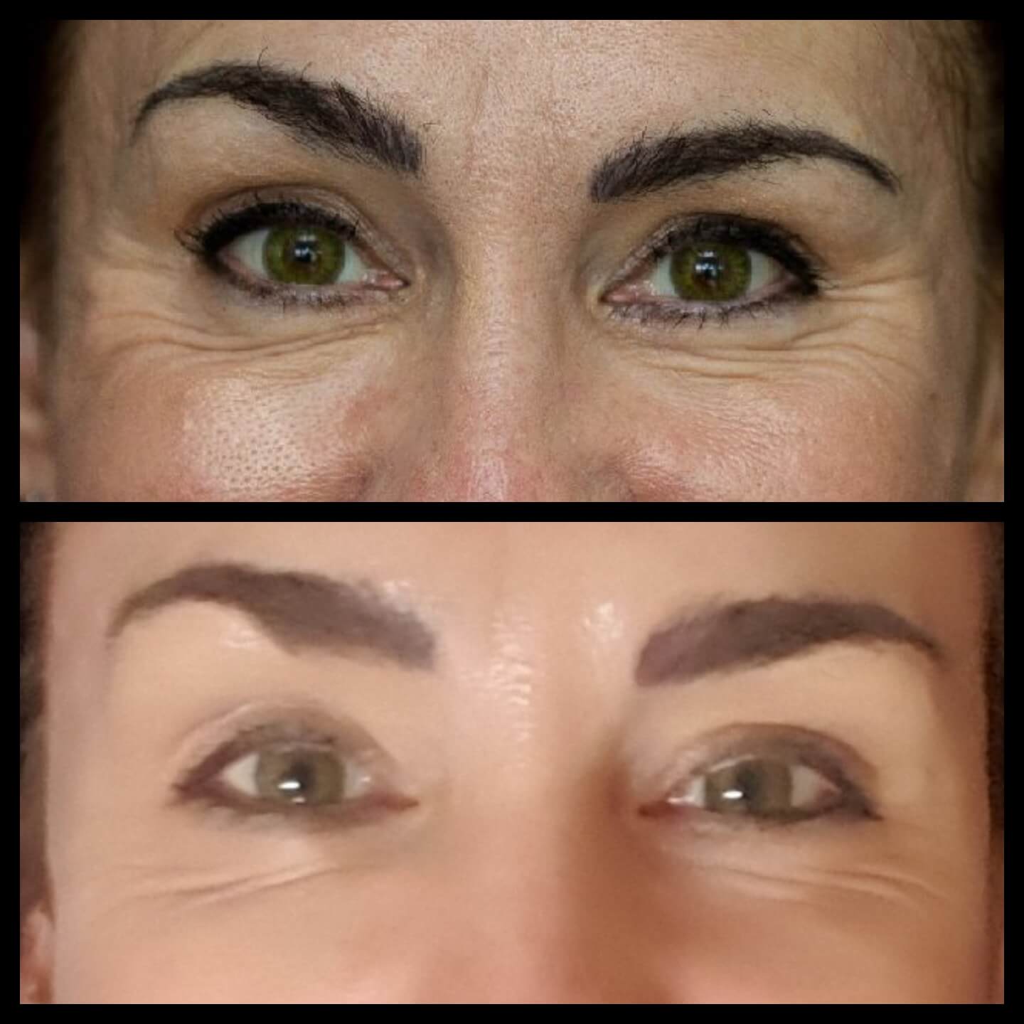 Laura's facial results