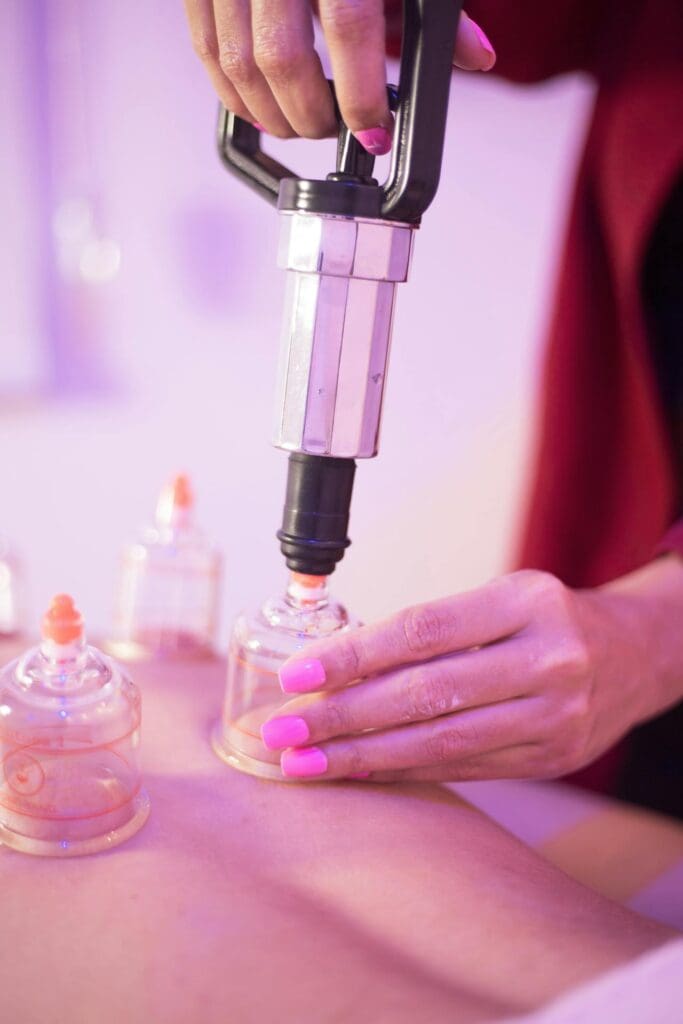 Doctor applying suction cups on patient back for cupping Houston therapy